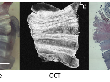 Microscope, OCT and histology of intervertebral disc