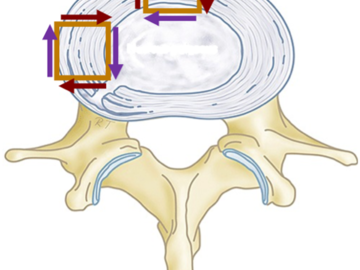 Disc depiction