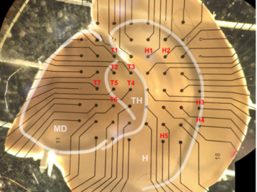 Recording electrical signals from a brain slice