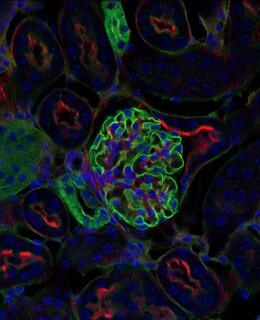 Airyscan Fast imaging